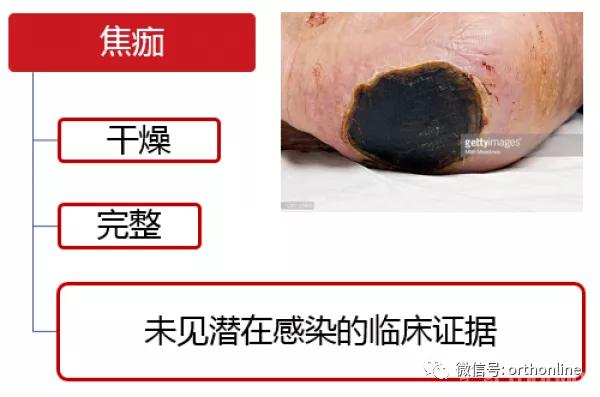 临床清创原则,临床清创