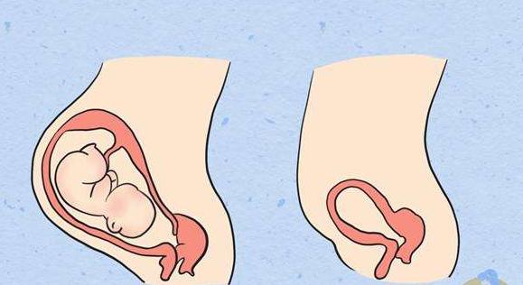 怀孕期间能否同房？提醒：若做好措施，还能收获这4个好处