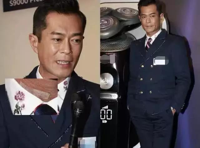 古天乐颈椎病手术,48岁的古天乐颈椎移位是什么病