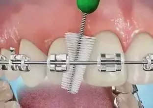 牙齿矫正出问题能要求赔偿吗,牙齿矫正越来越瘦什么问题