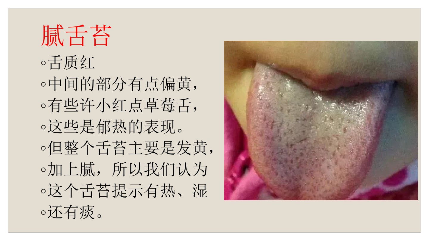 宝宝舌苔怎么辨别热还是寒,如何看宝宝舌苔来区别是否感冒