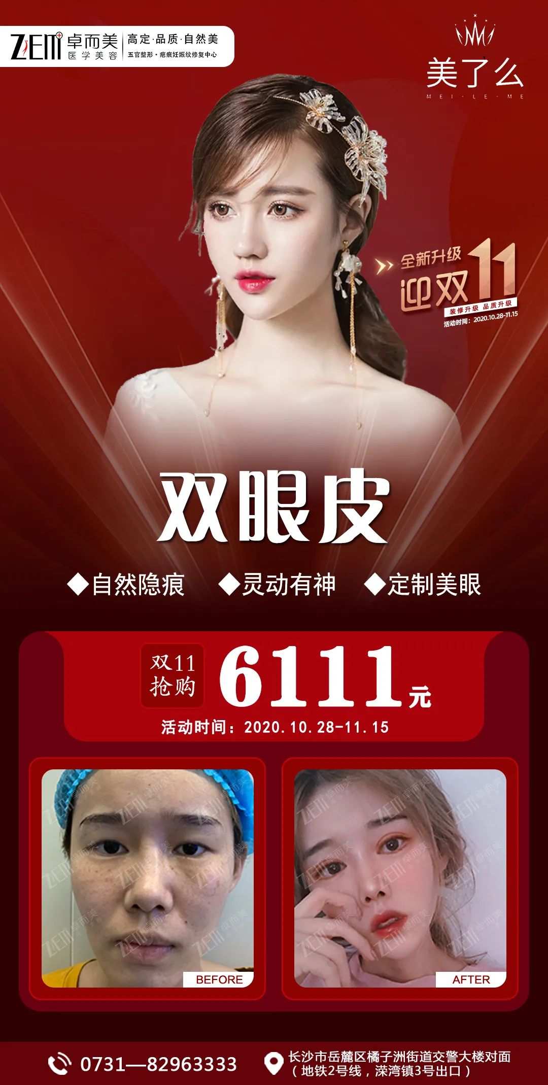 重磅！美了么“双十一”亿元补贴，携手百城专家团队来袭