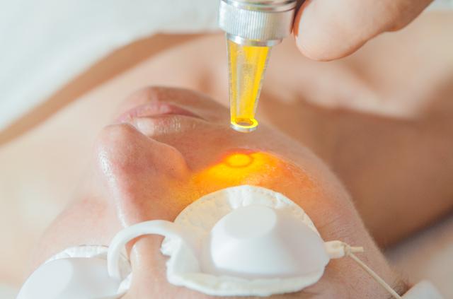 所谓收缩毛孔真的有用吗原理是啥,收缩毛孔的十大误区