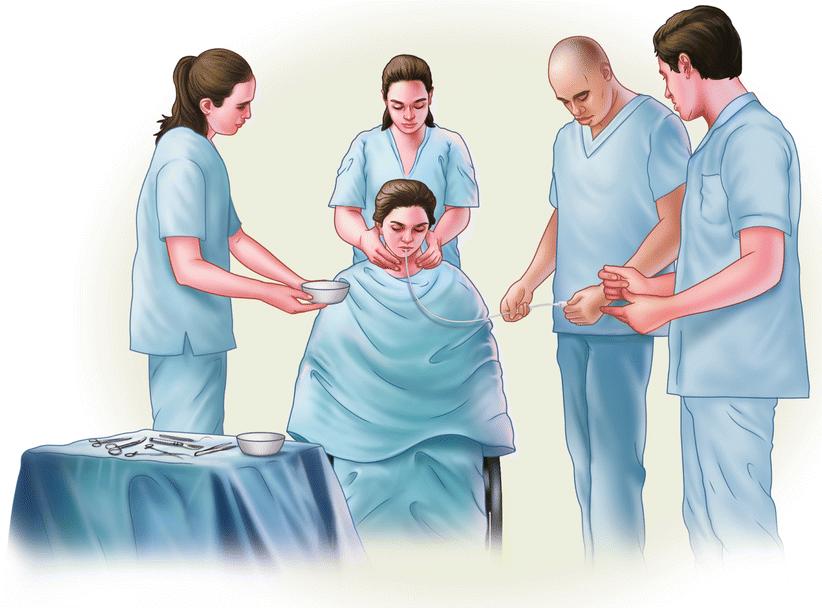 “*眠药安**自杀”没有痛苦？吞下100片*眠药安**后，你的身体会怎么样