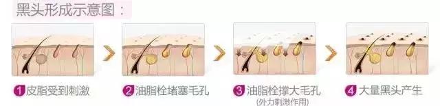 毛孔黑头去除神器小灯泡,吸黑头神器毛孔清洁仪器康佳