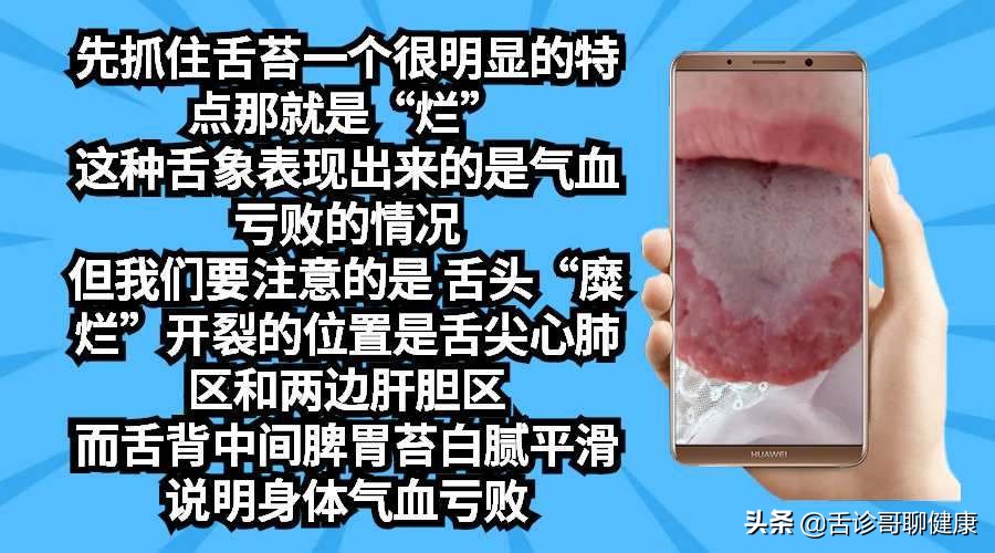 抖音舌诊哥舌象感悟：强迫症、大便不成型、忧心忡忡
