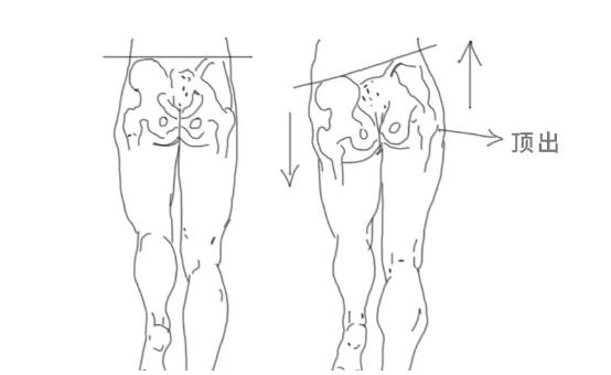 假胯宽真的能挽救吗,假胯宽大腿粗怎么办