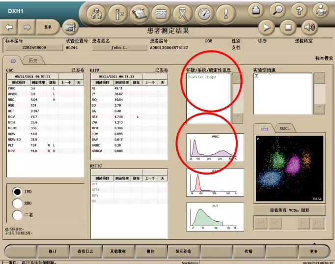 “秒”看血小板聚集，你get到了吗？