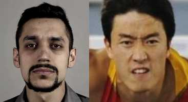 单眼皮肿眼泡割双眼皮多少钱,为什么单眼皮的人喜欢双眼皮