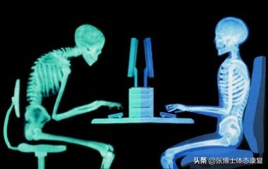 体态矫正有哪些坑,体态矫正开始难受