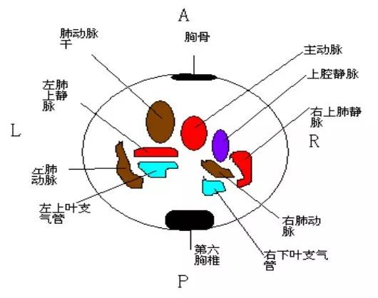 胎儿心脏三种血管关系模式图,25周的胎儿心脏弓切面多少正常