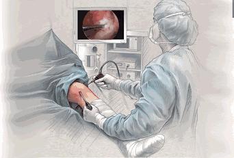 关于扁平疣的治疗,皮肤扁平疣能彻底根治吗