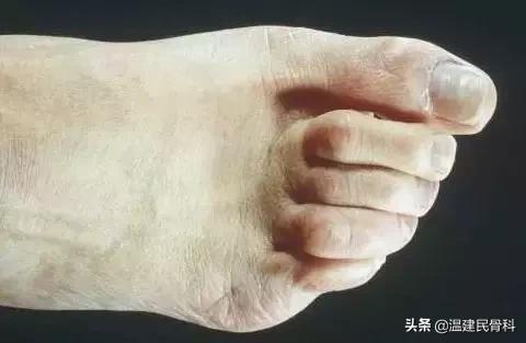 cctv2019年3月25日健康之路节目,cctv10健康之路4月1日回放