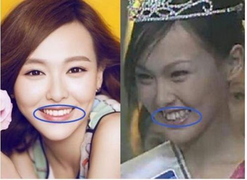 哪些明星整牙后像整容,明星整牙变美了