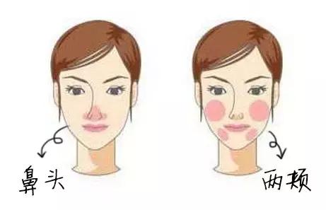 泛红期的红血丝怎么治疗,泛红的红血丝几天能好