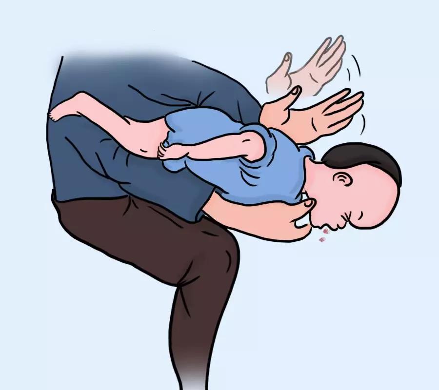 食物卡喉自救原理,食物卡喉咙自救