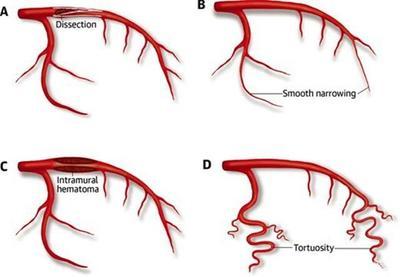 做心脏造影会不会伤害心脏,做心脏造影会不会伤到血管