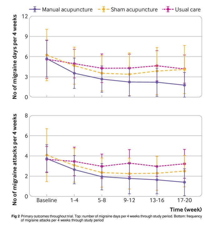 华科学者在顶级期刊BMJ发表论文：中医手针缓解偏头痛