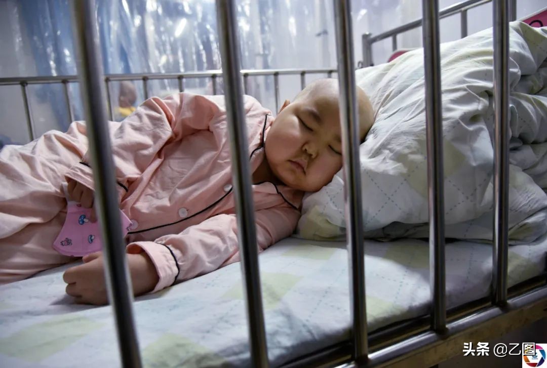 小孩被器官移植,5岁女孩移植