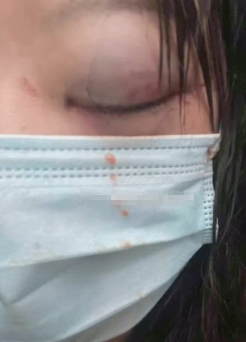 抖音被家暴戴眼镜的男网红,网红被家暴事情