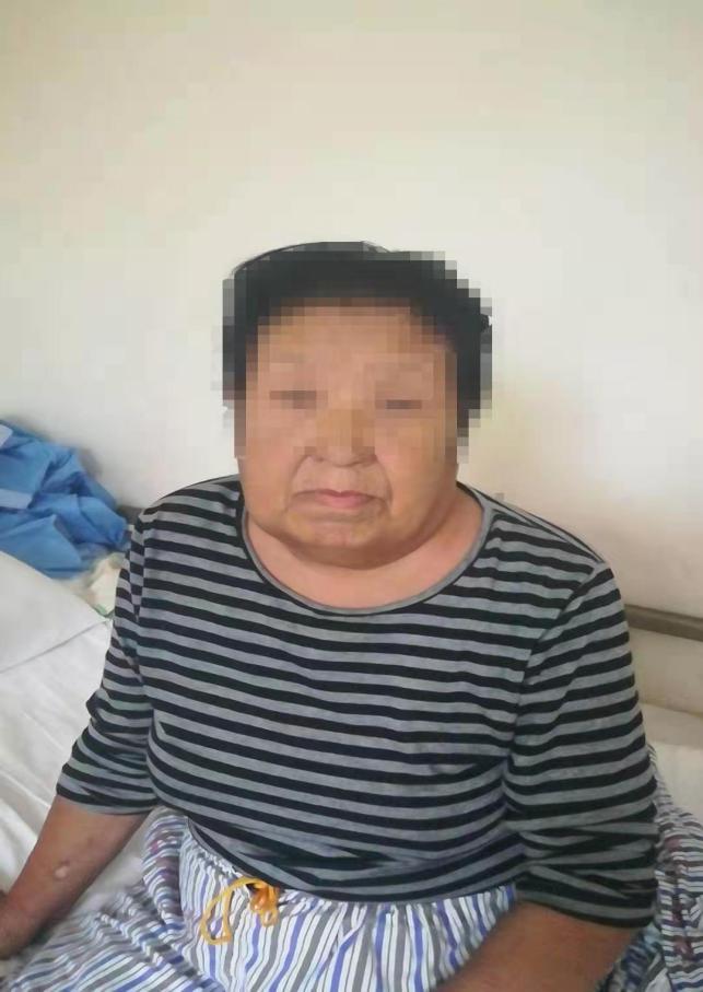 透析患者上肢肿胀原因及处理,血液透析并发症及处理