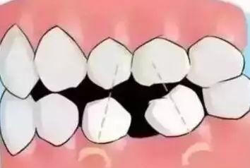 想去种牙,医生却说种不了?看看这位过来人经历了什么