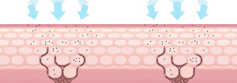 皮肤白不白无所谓，别再暗沉了可以吗？