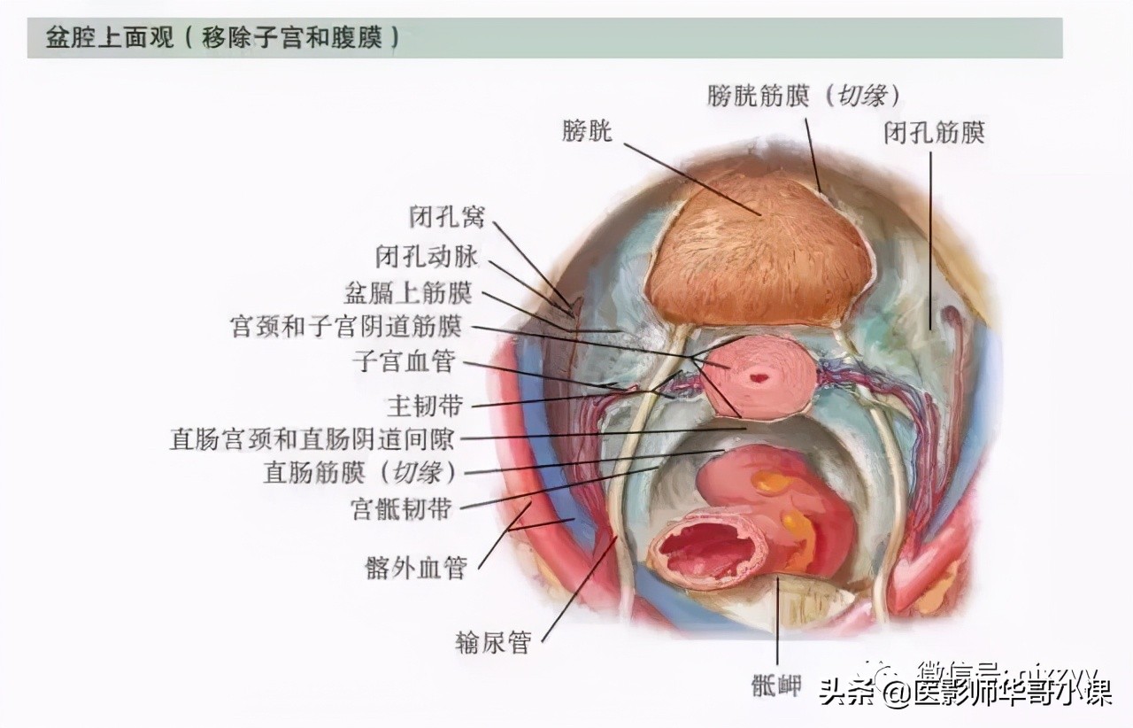 盆腔积液ct解剖图谱,盆腔解剖图谱手绘步骤