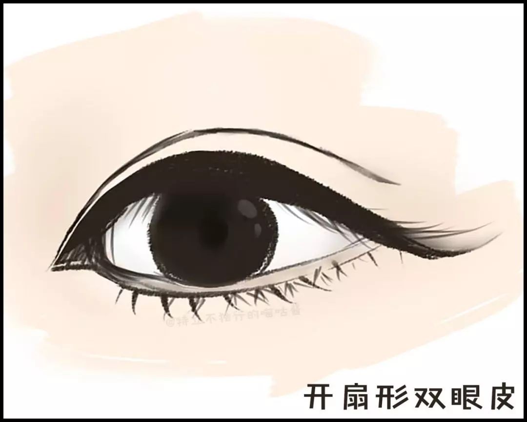 割双眼皮术前术后对比图,割双眼皮术前需要注意事项