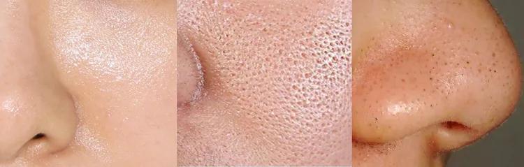 细致毛孔光滑肌肤,真正精致的女人都很高级