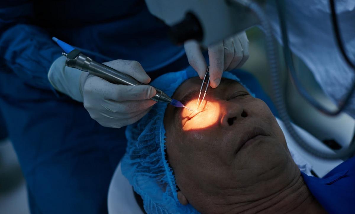 近视手术常见后遗症真相原来如此,近视手术后你后悔了吗