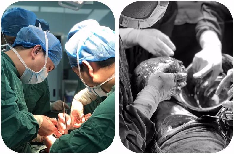 漳州第三医院:一男子高烧39.8℃被紧急送医,检查后发现肚里居然藏着“定时*弹炸**”