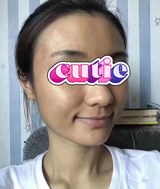 感受一下中药面膜效果,中药面膜无尴尬期效果对比