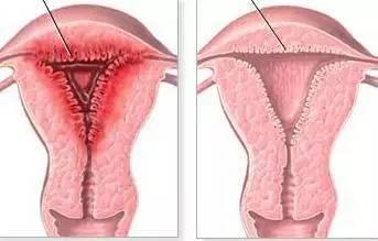 白带都有哪种症状,白带什么颜色是癌症的前兆