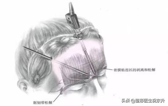 各种除皱方式你选对了吗,最权威最有效的除皱产品
