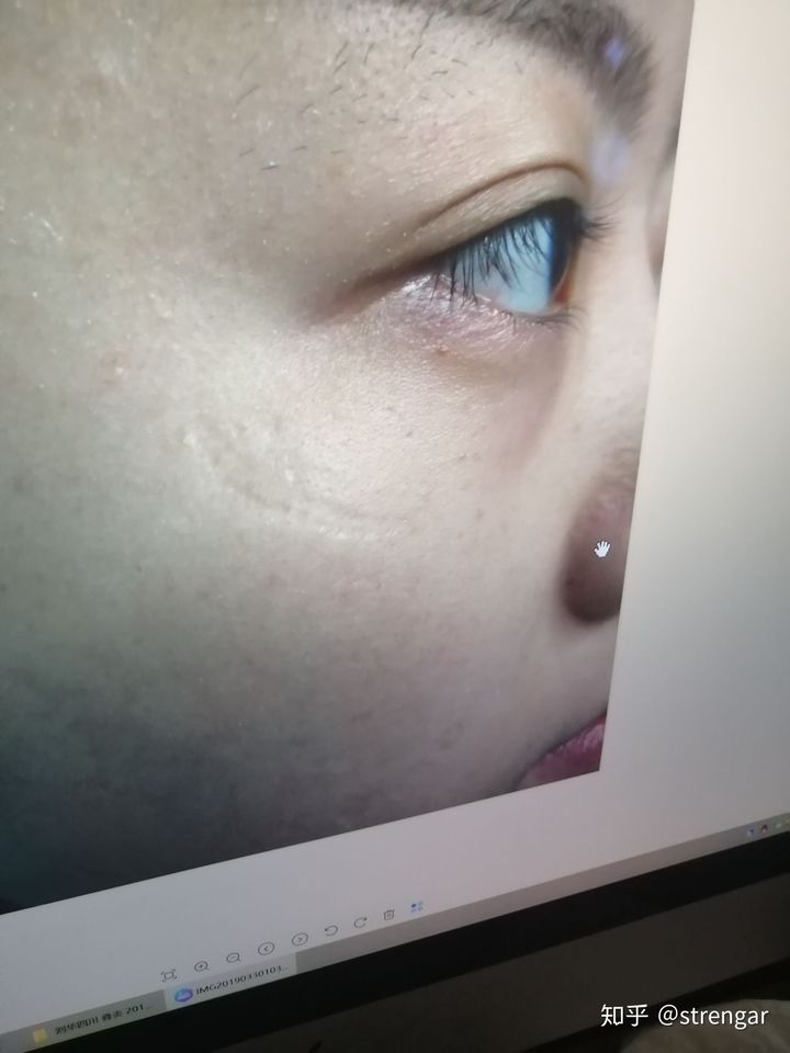 陈金西细胞种植可靠吗,陈金西细胞再生技术疤痕修复