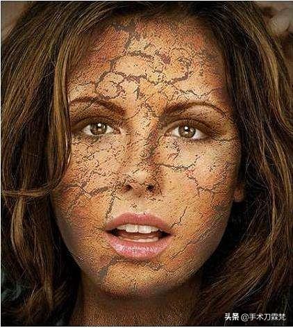 冷空气皮肤起疙瘩怎么办,冷空气一来脸部干燥起皮