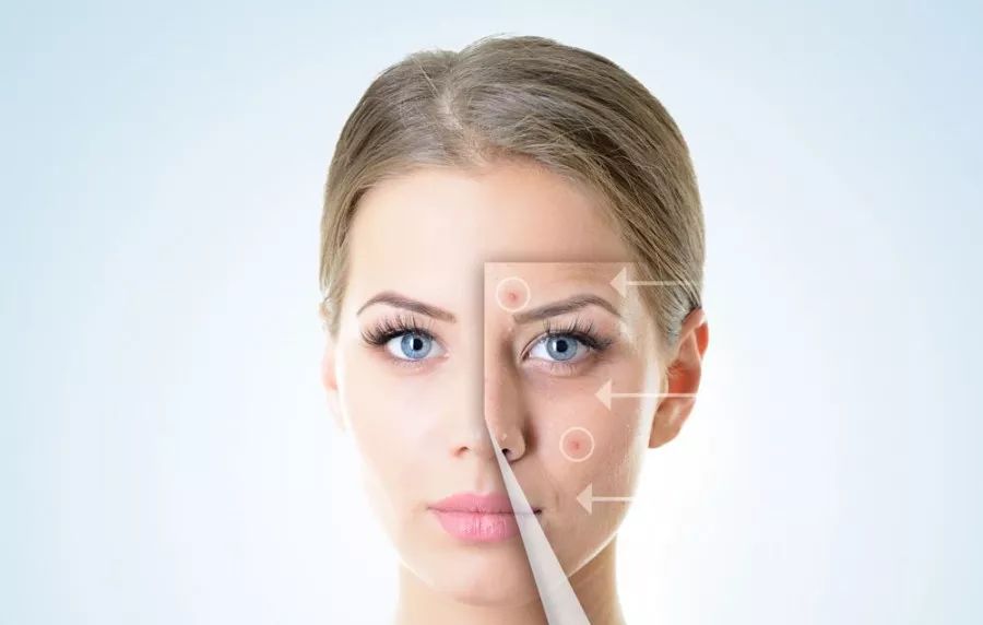 苨萃（NICUI）护肤：皮肤营养过剩，究竟是谁惹的祸？