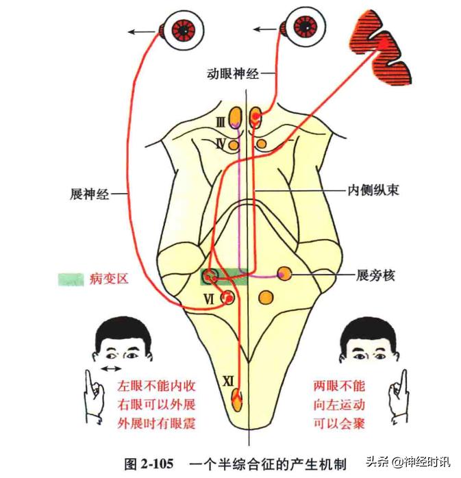 脑干解剖,脑干神经解剖