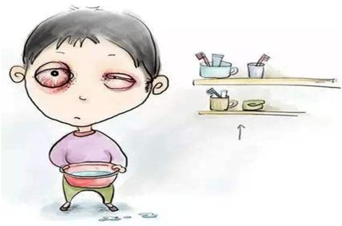 类风湿引起的眼睛干涩怎么办,类风湿导致的眼睛不舒服怎么治疗