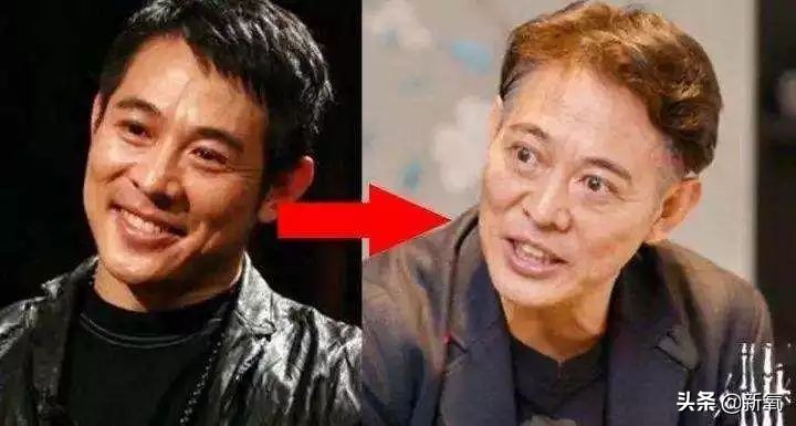 抢了刘亦菲干爹还发博踩天仙，但她这个部位肿得惊人