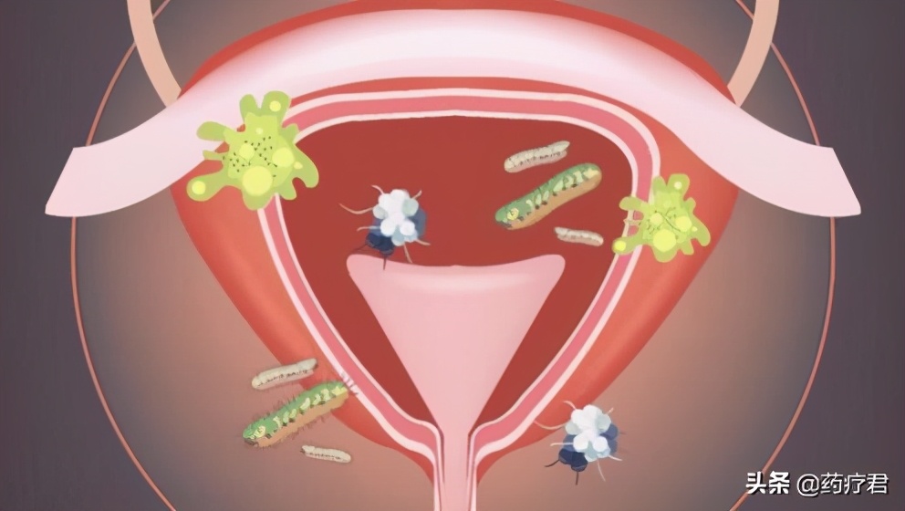 姨妈期间有避孕会不会怀孕,姨妈刚走采取避孕会不会怀孕