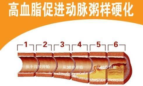 血脂异常多少需药物治疗,血脂高于多少必须用药控制