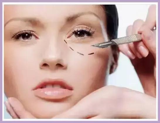 这些年我们踩过的护肤坑,目前最靠谱的去眼袋方法