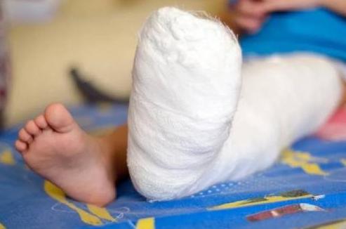 当孩子被烫伤时，用这5个步骤缓解