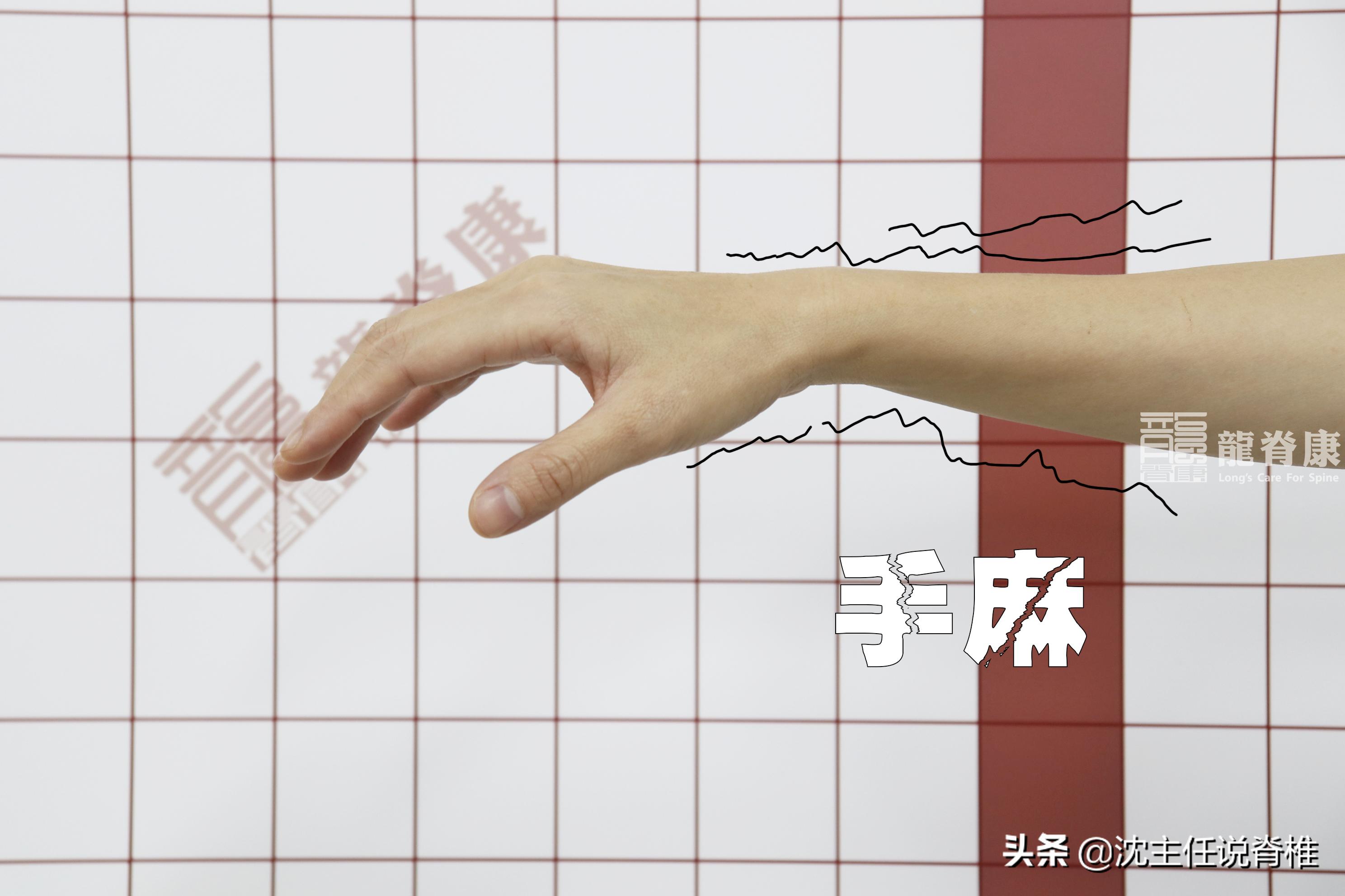 手麻是颈椎引起的吗吃什么药,颈椎病引起头胀痛的症状