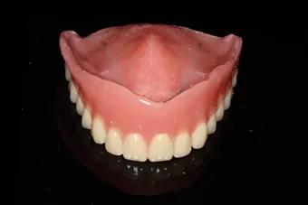 我才20岁为什么牙齿会碎掉,27岁缺牙不补有什么坏处