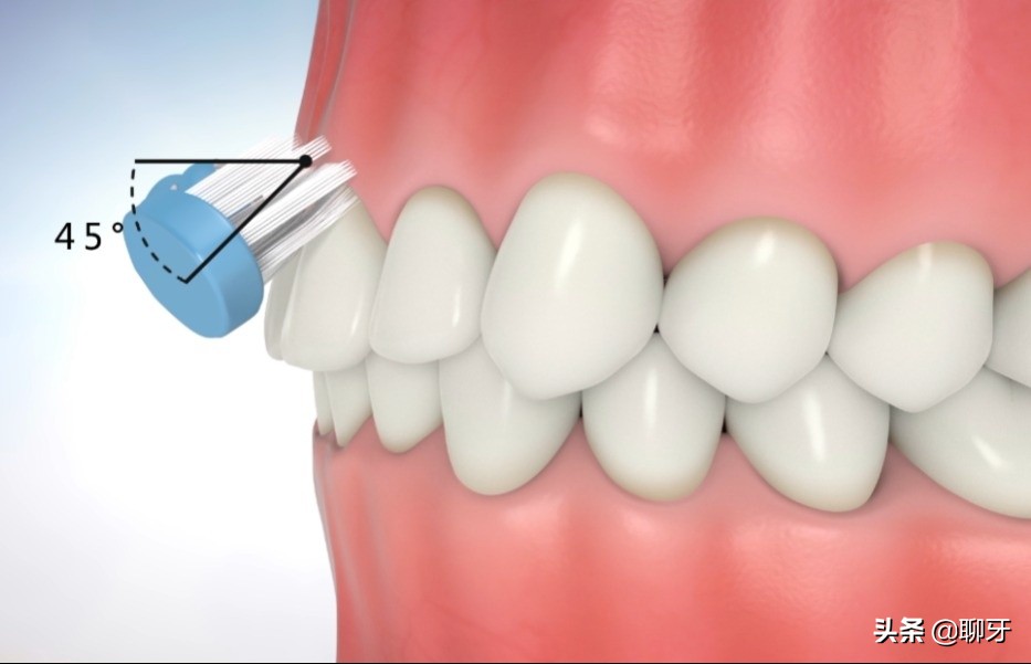 牙齿需要种植牙会经历几个步骤,种植牙流程什么情况需要做骨粉