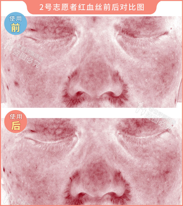 300块的网红美容仪有效果吗,网红家用美容仪测评