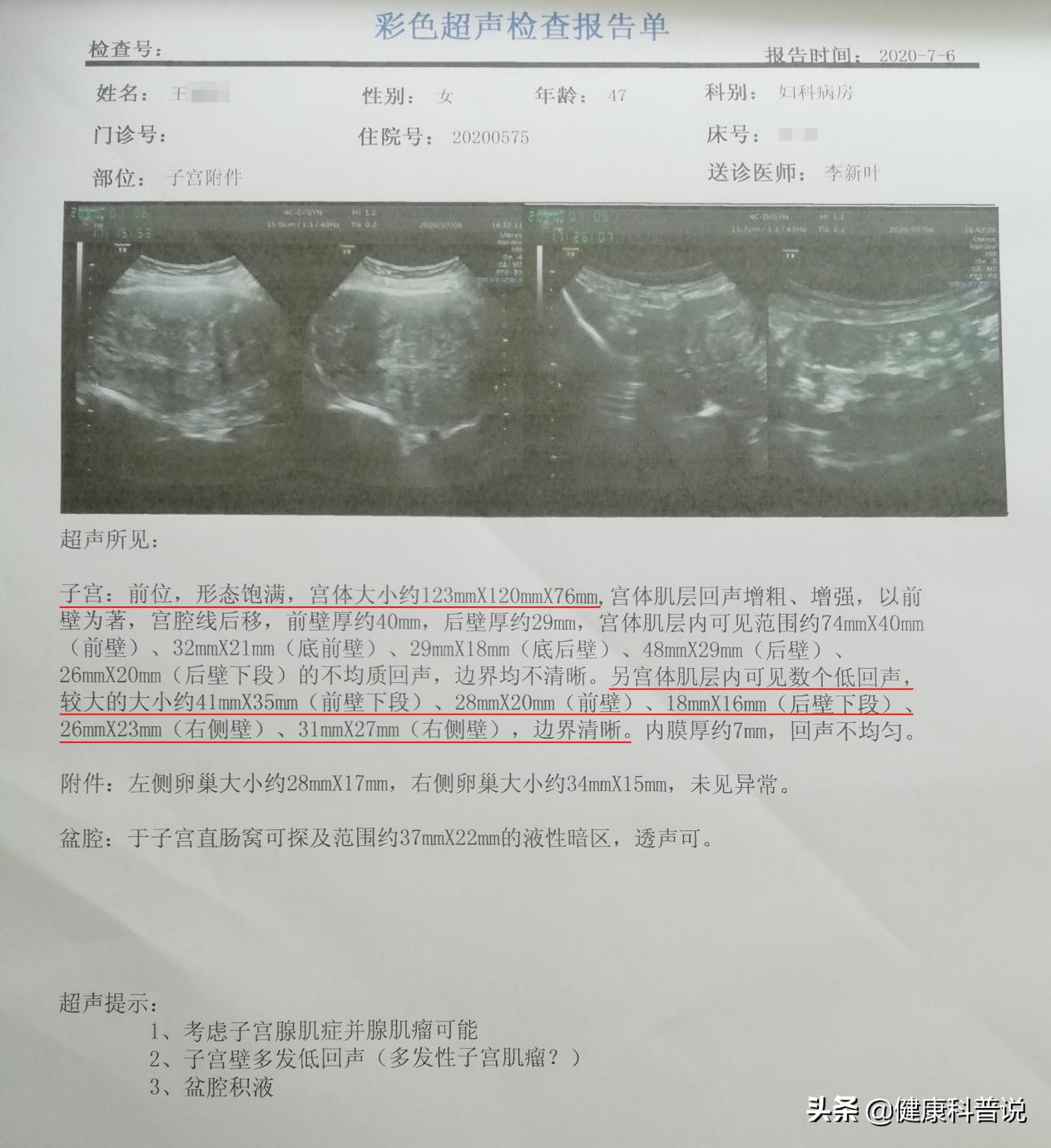 腺肌症保宫手术让你和痛经说再见,子宫腺肌症痛经死去活来